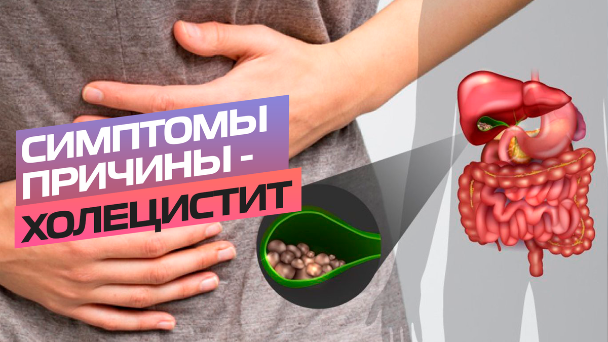 Холецистит - симптомы, причины и лечение | shodnya.med | Дзен