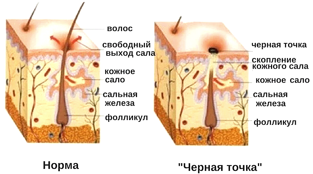 Тип сальных желез кожи