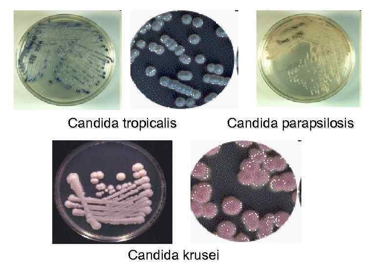 Грибы кандида. Candida SPP микробиология.