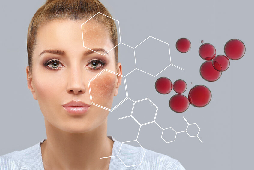 Стоп, пигментация!