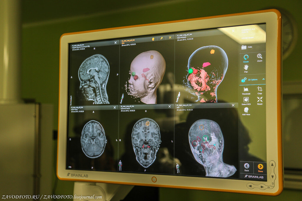 Сайт нейрохирургии тюмень. Новосибирск нейрохирургический центр. Нейрохирургия Тюмень. Нейрохирургический центр Тюмень. Навигационная станция в нейрохирургии.