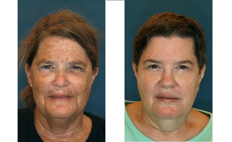 Сестры-близнецы, угадайте , которая из них жила в солнечном городе, а какая в северном?