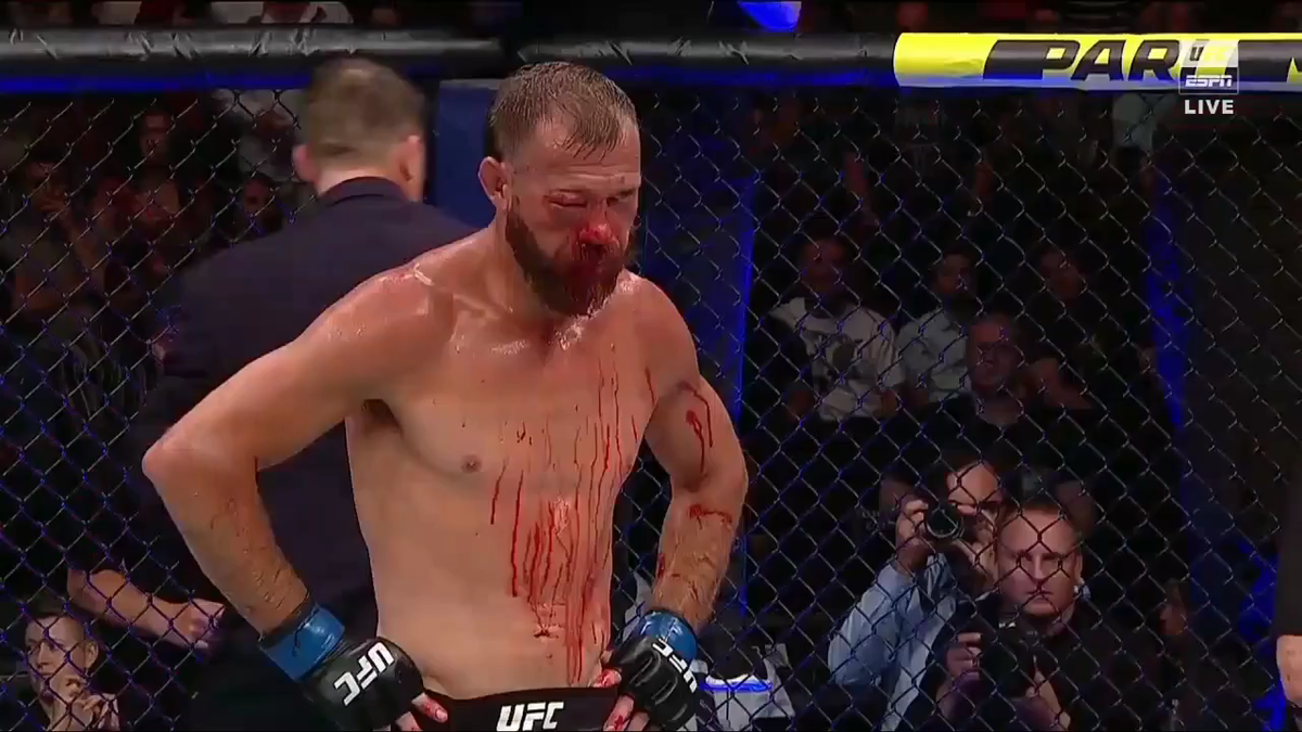 Дональд Серроне после остановки боя 