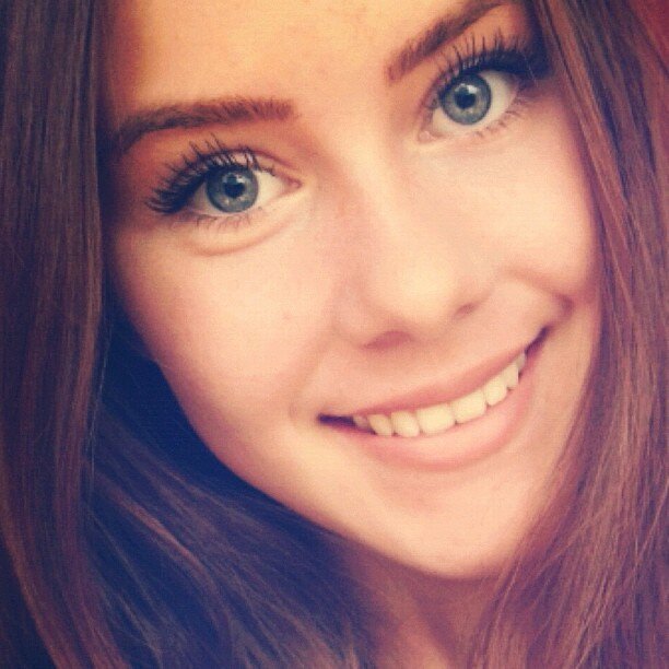 

Болезнь Паркинсона поражает "рыжих" чаще, ученые утверждают, что лет через сто рыжеволосые люди исчезнут