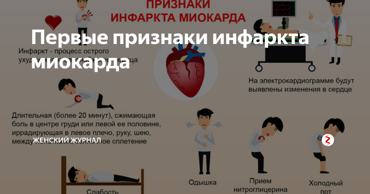 Микроинфаркт признаки