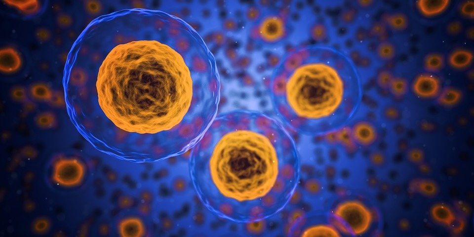 Source: https://pixabay.com
