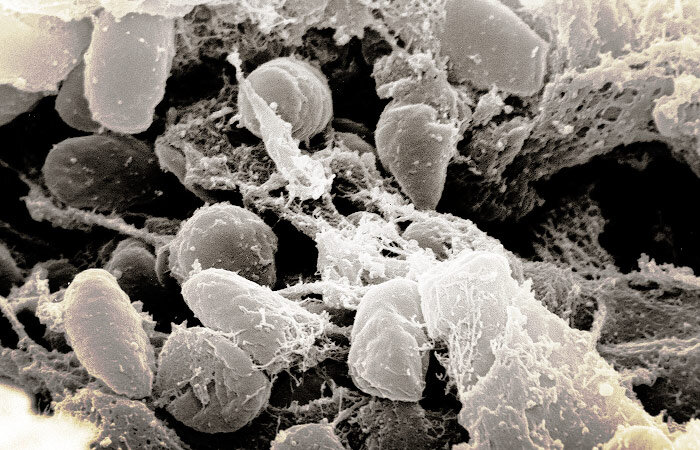 Чумная палочка (Yersinia pestis)