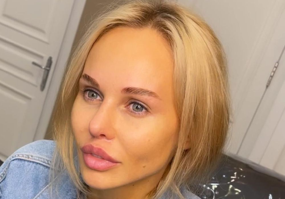 Надежда санько до и после пластики