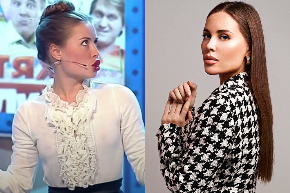Юля михалкова до пластики и после фото