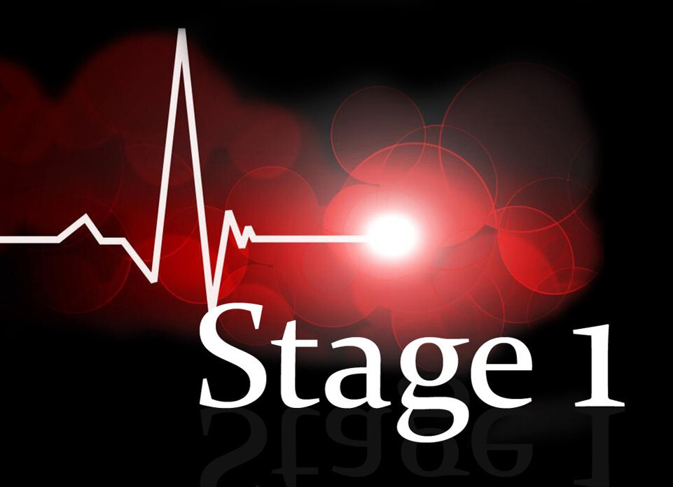 Stage 2. Стейдж 1. Что такое Stage в тюнинге. Stage чип.