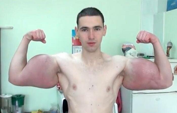 Источник фотографии: http://en.3yonel7ds.com