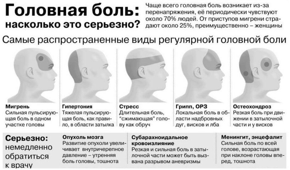 Частые головные боли: причины и лечение