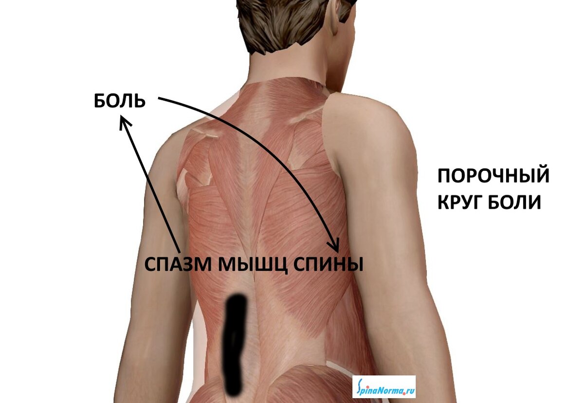 Как снять спазм мышц