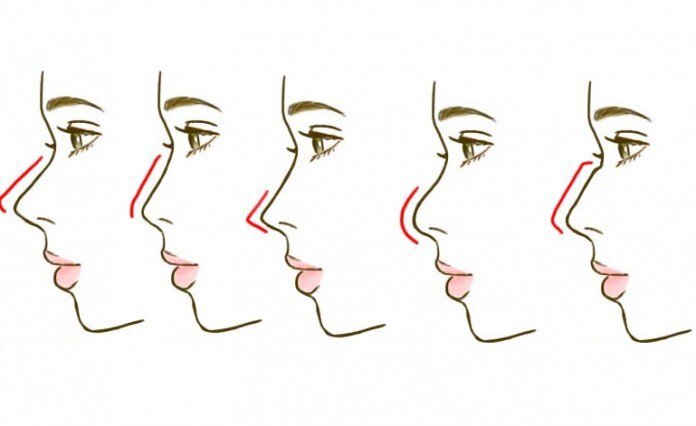 Форма носа у женщин