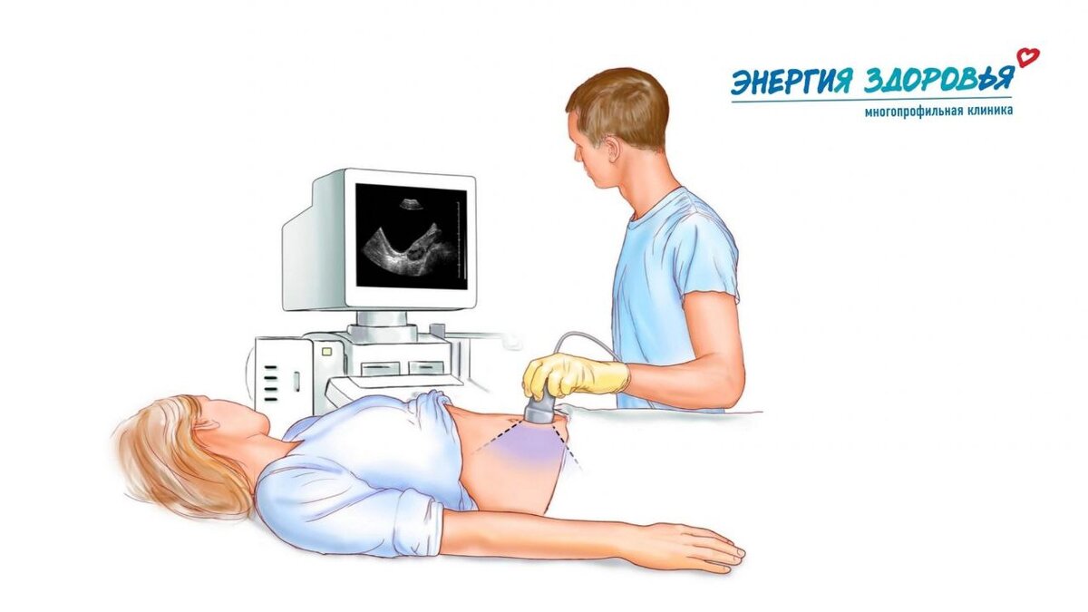 УЗИ. УЗИ мочевого пузыря протокол. УЗИ почек диагностическая значимость. Подготовка к УЗИ почек у женщин памятка.