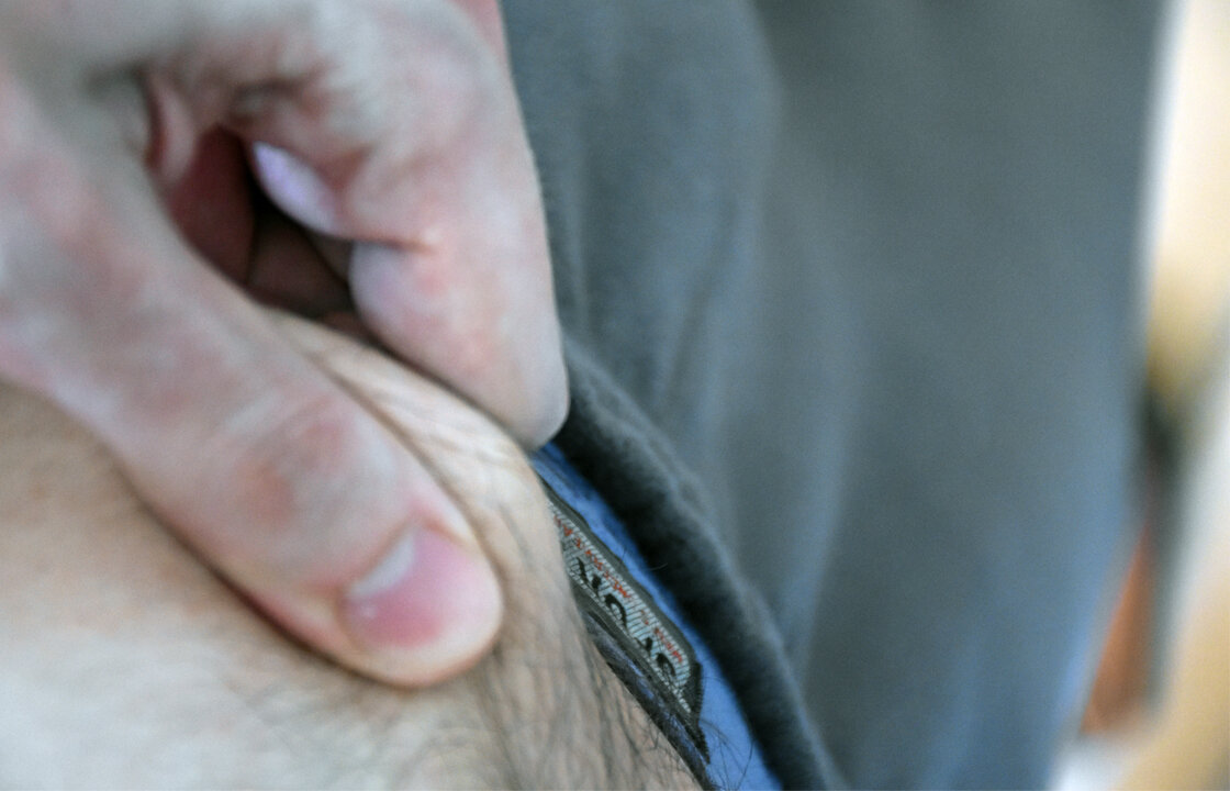 Подкожный жир на животе