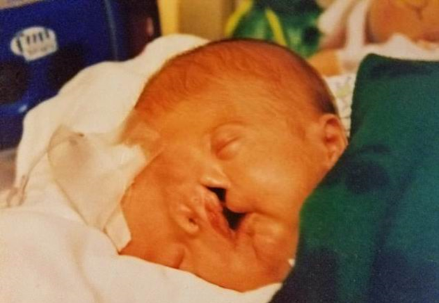 Малыш одновременно шокировал и вызывал восхищение. Одна сторона его лица напоминала нашего старшего сына, другая — среднего.