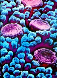 Микробы гнездятся между вкусовыми сосочками языка.