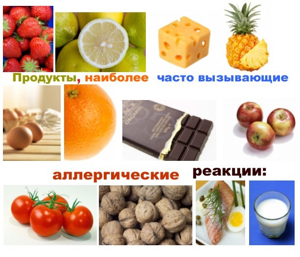 ПСЕВДОАЛЛЕРГЕНЫ Псевдоаллергены- это те продукты и вещества , при употреблении которых 
запускаются механизмы развития пищевой непереносимости . Псевдоаллергенов  множество, разберём основные из них .
✔️В роли псевдоаллергена может выступать абсолютно любой продукт при заболеваниях  органов желудочно - кишечного тракта . Это именно про то, что «сыпет на все»
✔️При недостатке фермента ЛАКТОЗЫ псевдоаллерген -молоко 🥛 , 
🔻При дефиците фермента , участвующего в переваривании фруктозы - фрукты  🍉🍇🥝🍍🍑🍈
🔻При дефиците фермента, участвующего в усвоении алкоголя- алкоголь 🥂🍾. Это именно про то, кто переносит алкоголь хоть в каком количестве , а кому- то достаточно глотка и на этом все . В усвоении алкоголя участвует не только один фермент , поэтому развитие псеадоаллергической реакции высоко вероятно по разным механизмам.
🔻При дефиците ферментов , участвующих в переваривании сахаров в роли псевдоаллергена могут выступать сахара -именно отсюда «растут ноги» уже известной  всем FODMAPs -диеты.
✔️Изолированная непереносимость  пищевых добавок и красителей существует , но встречается крайне редко.
✔️И наиболее часто мы встречаемся с псевдоаллергенами в виде гистаминолибераторов -продуктов , содержащих биогенные амины , которые могут спровоцировать и усилить любой из вышеперечисленных  механизмов псевдоаллергии .О них мне хотелось бы поговорить подробнее .


