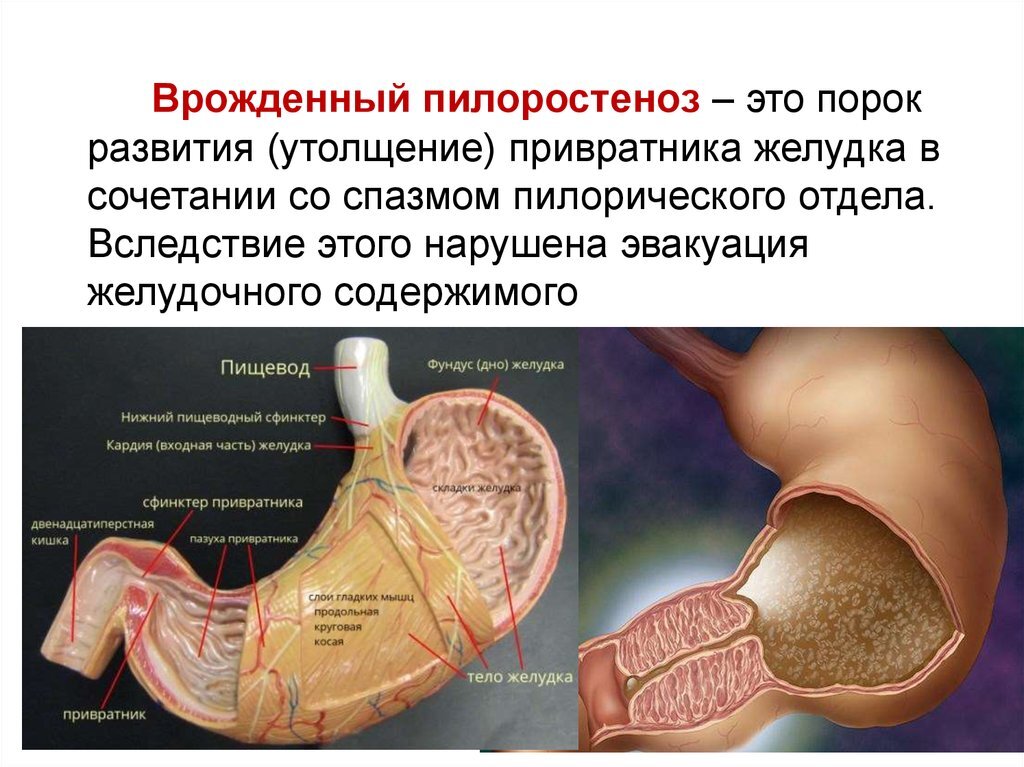 Патология Кардии - хроническое заболевание