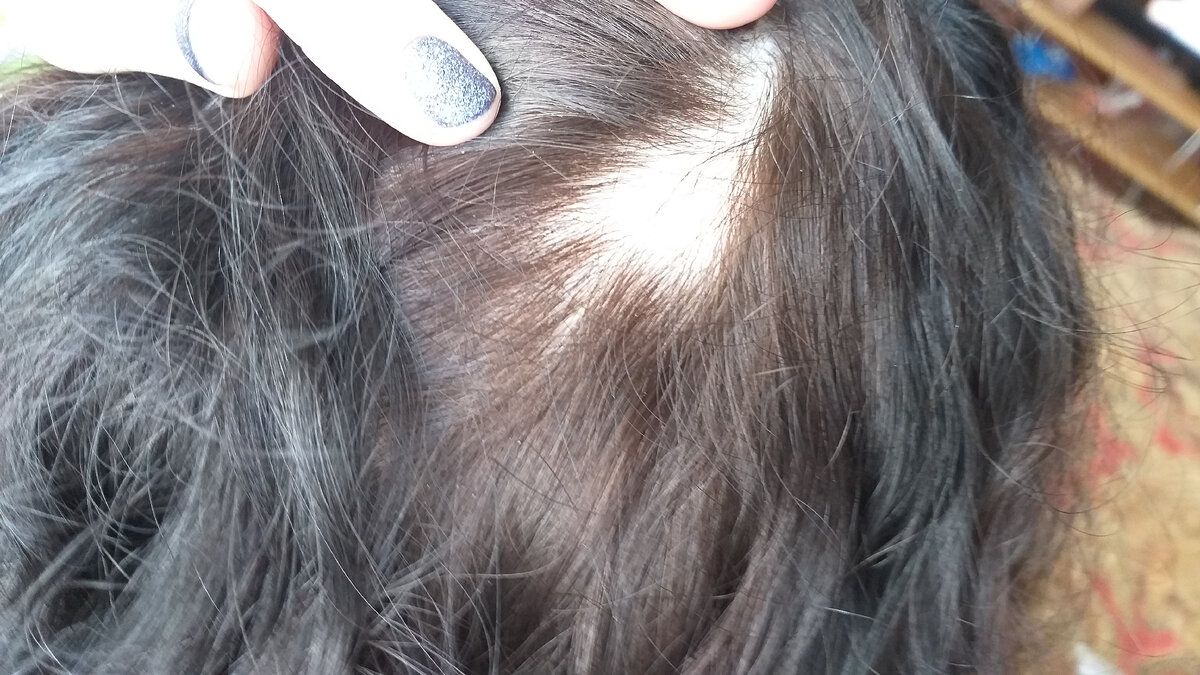 Вот как выглядел один из островков без волос