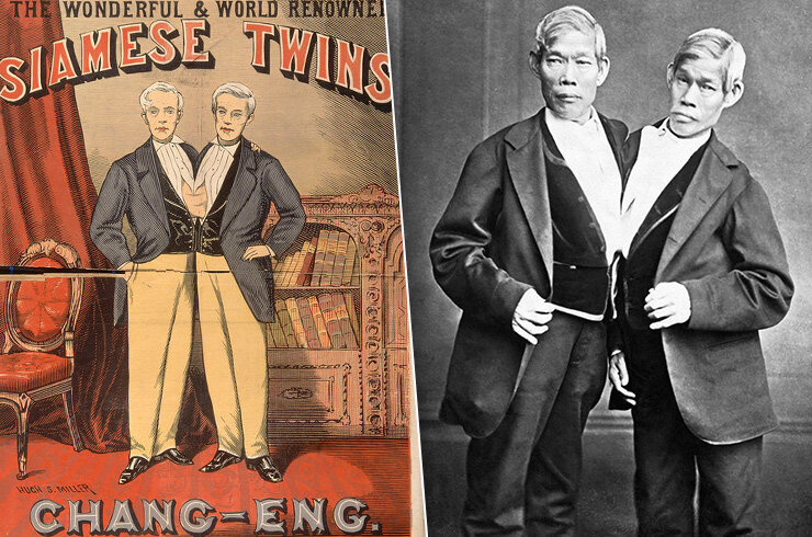 Сиамские близнецы чанг и энг