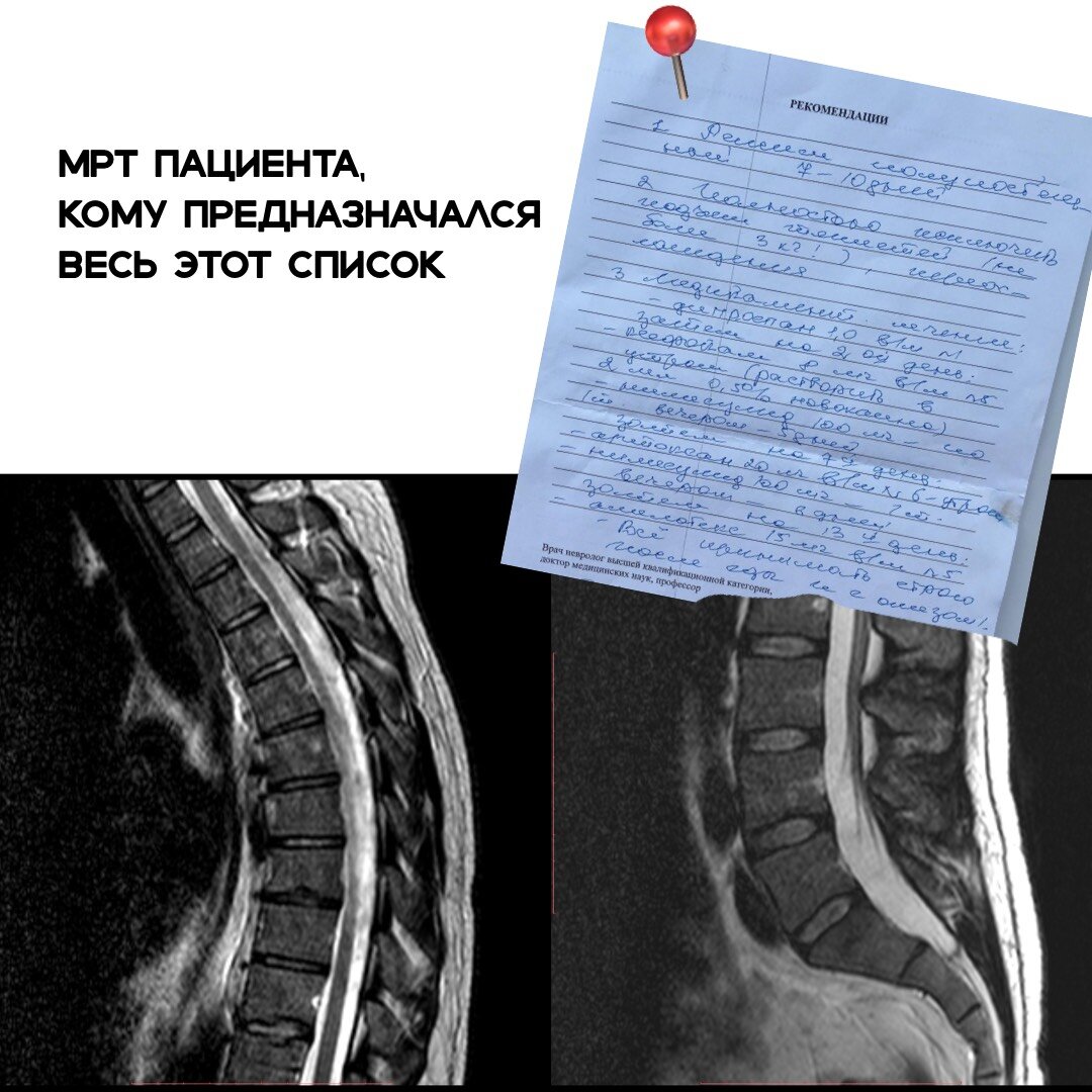 Вертеброгенная люмбалгия