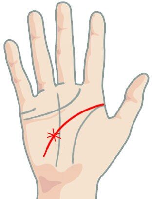 Звезда на линии головы