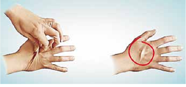 Слегка защипните небольшую область кожи на внешней стороне ладони.Если складка кожи разглаживается сразу – все нормально. Если же складка сохраняется и не разглаживается в течение даже небольшого промежутка времени – воды в организме не хватает.