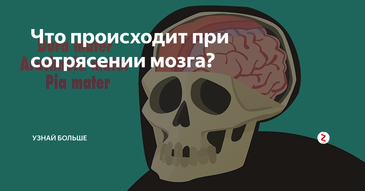 Спорт после сотрясения. Что происходит при сотрясении мозга. Препараты при сотрясении мозга. Как происходит сотрясение мозга.