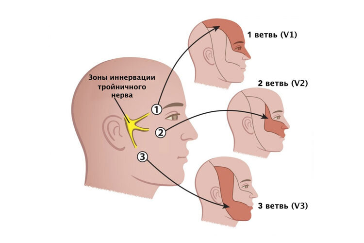 Воспаление тройничного нерва: причины, симптомы, диагностика и лечение