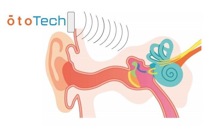 Принцип работы OtoTech