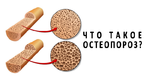 фото: https://www.youtube.com