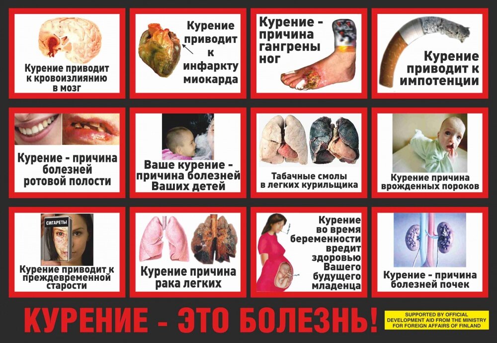 фото с сайта яндекс.картинки