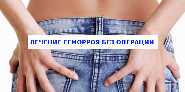 Лечение геморроя просто, быстро и без операций 