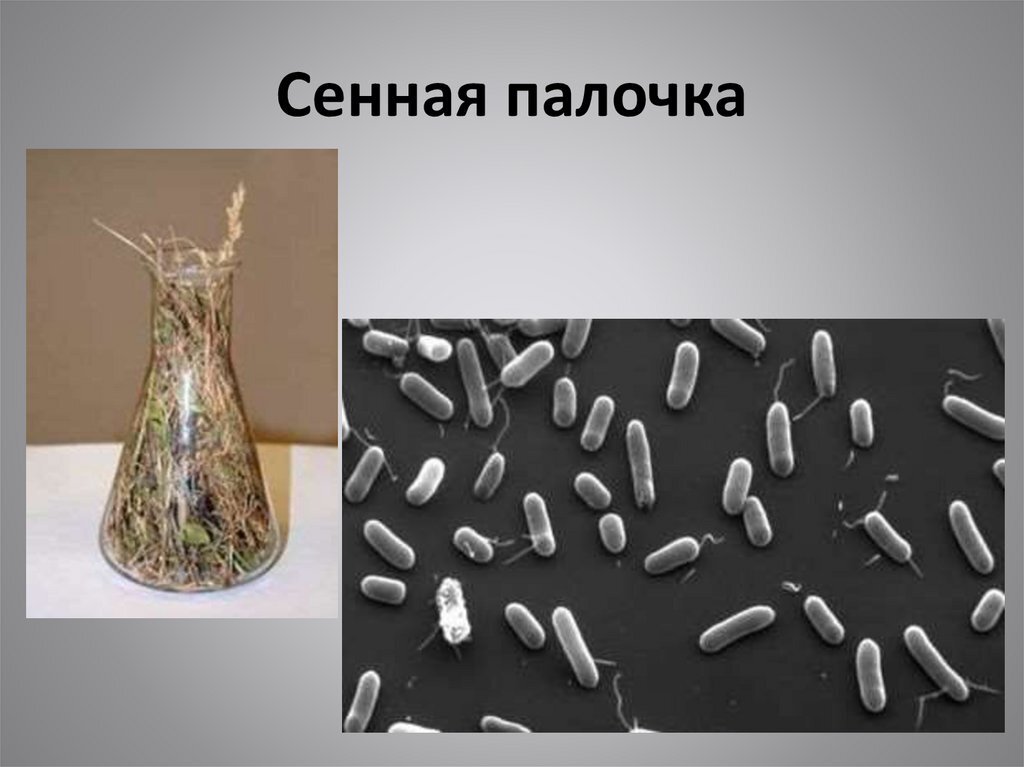 Бактерии палочки под микроскопом Сенная палочка для защиты растений и человека. Волшебная? Природная Энергия Дзен