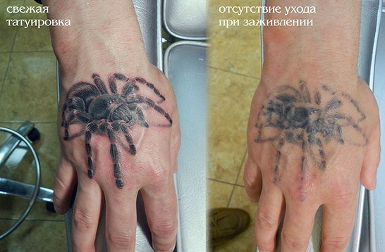 Вот такой рубец картинка