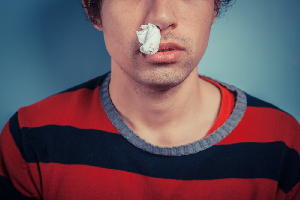   Кровотечения из носа чаще всего являются признаком местного или общего заболевания и бывают обусловлены строением носа и расположением сосудов.