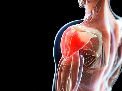 Почему мышцы болят на следующий день после тренировок?