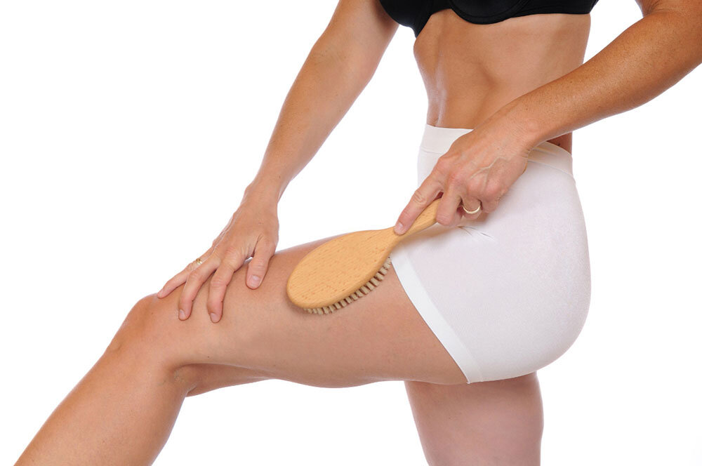 12 фактов о целлюлите, которые изменят вашу жизнь: все, что вам нужно знать