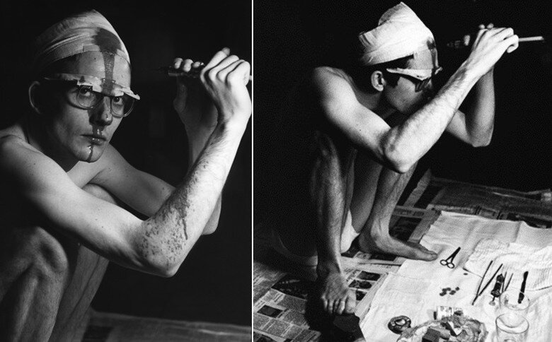 Хьюз во время операции без анестезии.