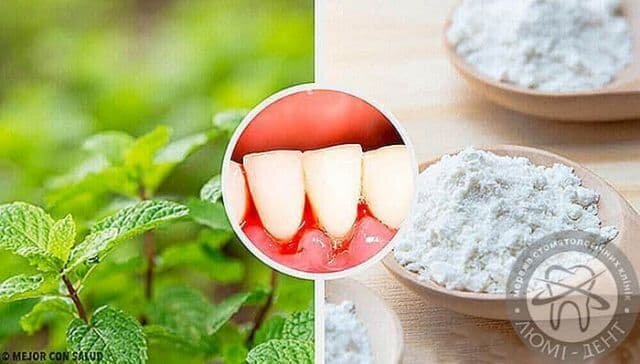 Методы профилактики