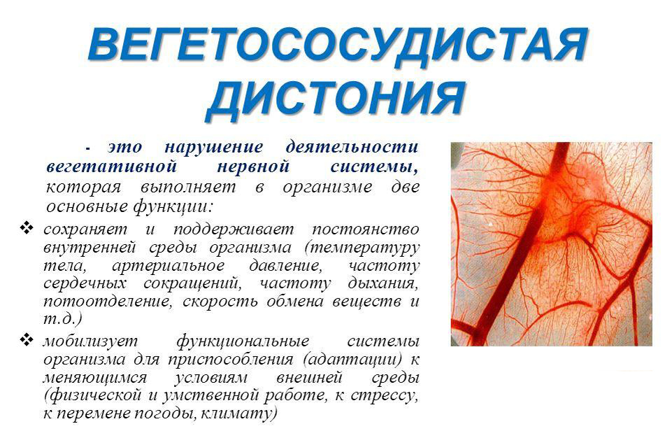Лечение вегето-сосудистой дистонии в Белоруссии - лечение ВСД