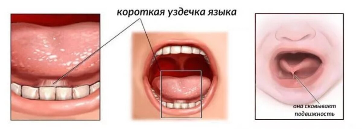 Фото взято в качестве иллюстрации у Яндекс-картинки 