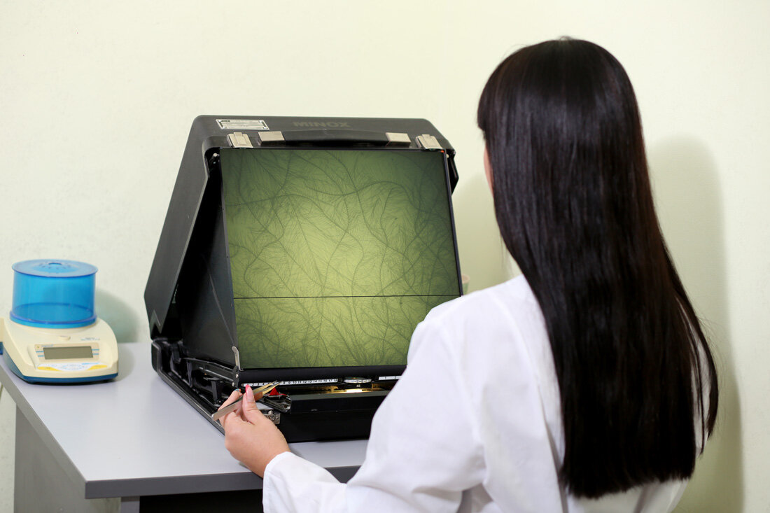 Пух рассматривают под микроскопом