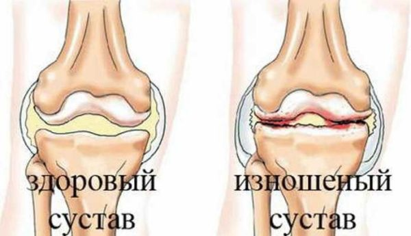 Остеоартроз и артрит у собак и кошек — симптомы и лечение