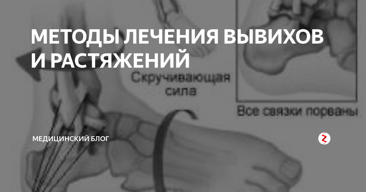 Особые растяжения для быстрого выздоровления