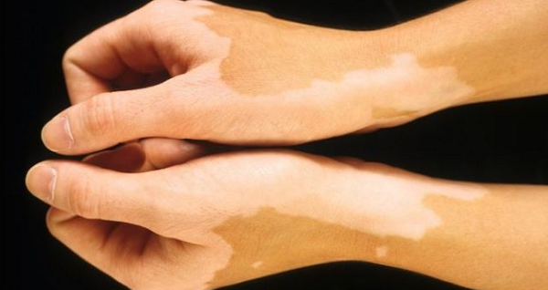 фото: https://womanadvice.ru/