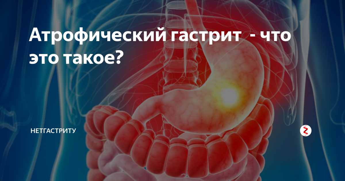 Атрофический гастрит пациенты отзывы. Атрофический гастрит прогноз для жизни. Атрофический вагинит картинки.