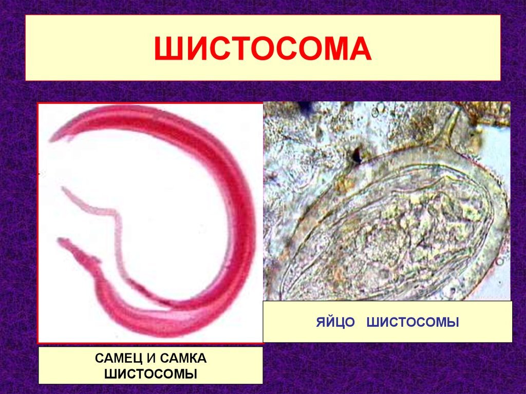 Кровяной сосальщик строение рисунок